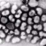 Transmission electron micrograph of influenza A virus.