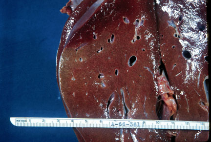 A normal liver, showing a fine lobular texture and smooth capsular surface.