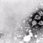 Transmission electron micrograph of hepatitis B virions.