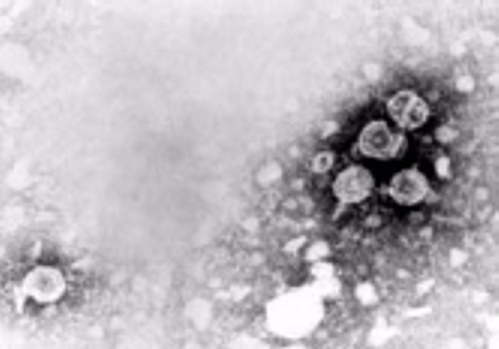 Transmission electron micrograph of hepatitis B virions.