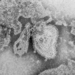 Electron micrograph of the mumps virus.