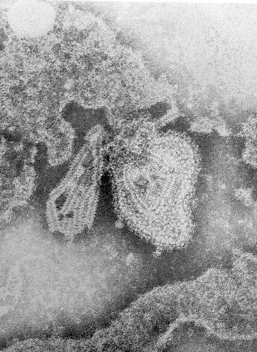 Electron micrograph of the mumps virus.