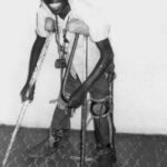 A young boy with polio using handmade braces, in Kenya.