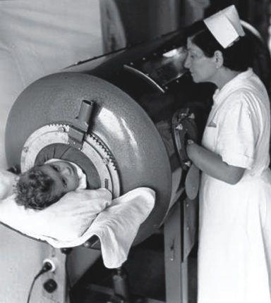 Patients whose respiratory muscles were affected placed in an iron lung machine to enable them to breathe.