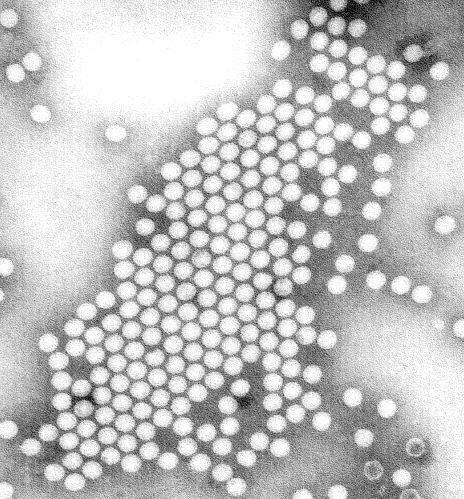 Negative stain image of the polio virus.
