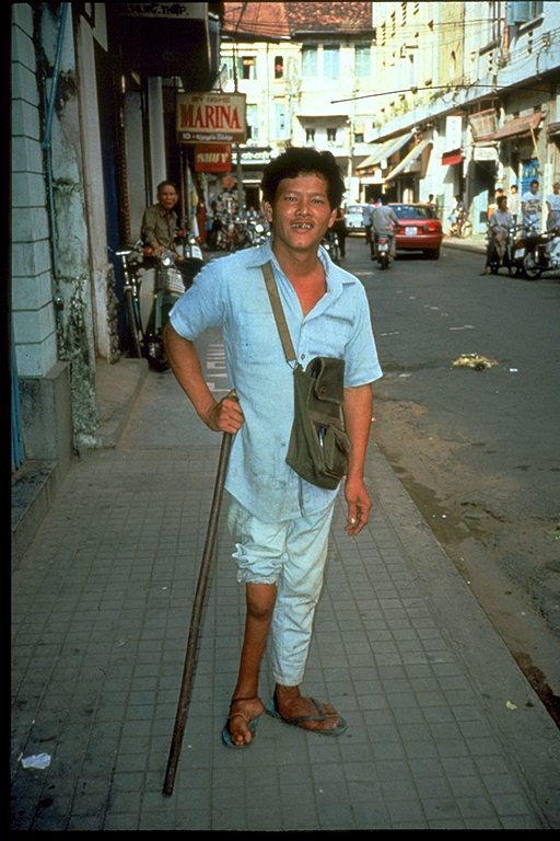 Young man with a withered leg due to polio outside on a sidewalk, using a cane.