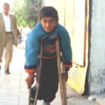 A boy paralyzed from polio infection standing in a thoughway outdoors.