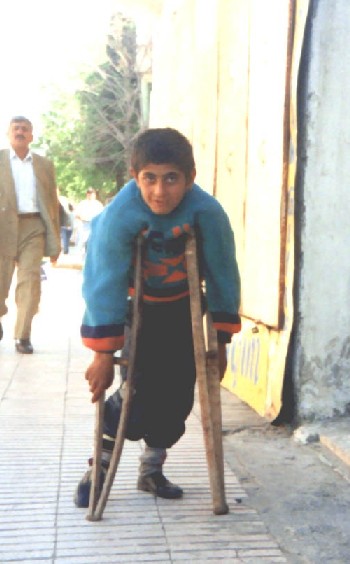 A boy paralyzed from polio infection standing in a thoughway outdoors.