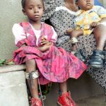 Two children in their mother's lap, each with polio in the Democratic Republic of Congo (DRC), Kisangani.