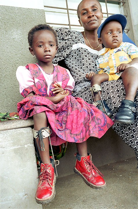 Two children in their mother's lap, each with polio in the Democratic Republic of Congo (DRC), Kisangani.