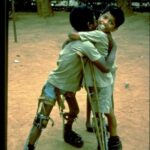 Two boys with polio hugging each other in the street.