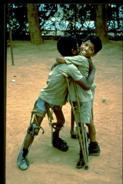 Two boys with polio hugging each other in the street.