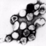 Visual of a transmission electron micrograph of rubella virus.