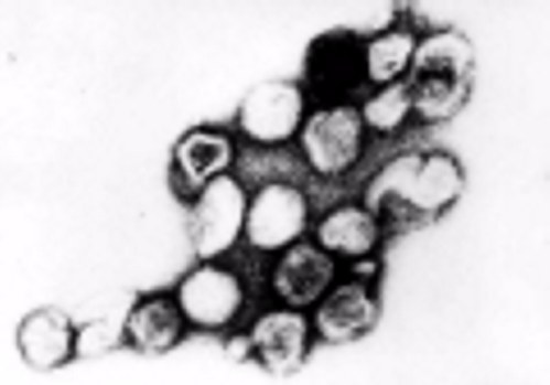 Visual of a transmission electron micrograph of rubella virus.