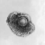 Electron micrograph of the chickenpox (varicella) virus.